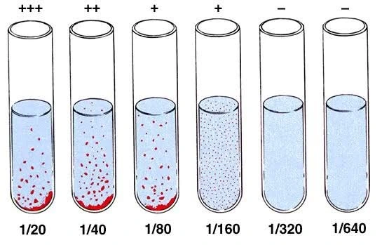 Widal Test! কী কেন কিভাবে?