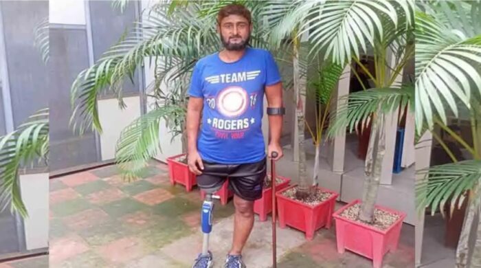 কৃত্রিম পায়ে ঘুরে দাঁড়ানোর স্বপ্ন দেখছেন ২৮ জুলাইযোদ্ধা